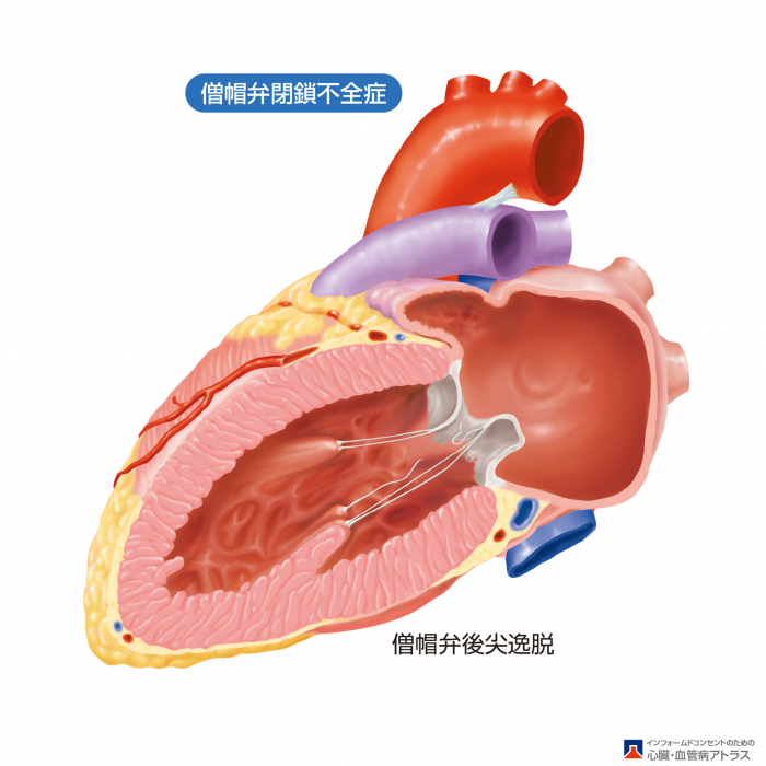 心雑音について さいとう内科 循環器クリニック